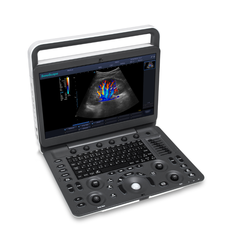 Sonoscape E2 Pro Ultrasound System