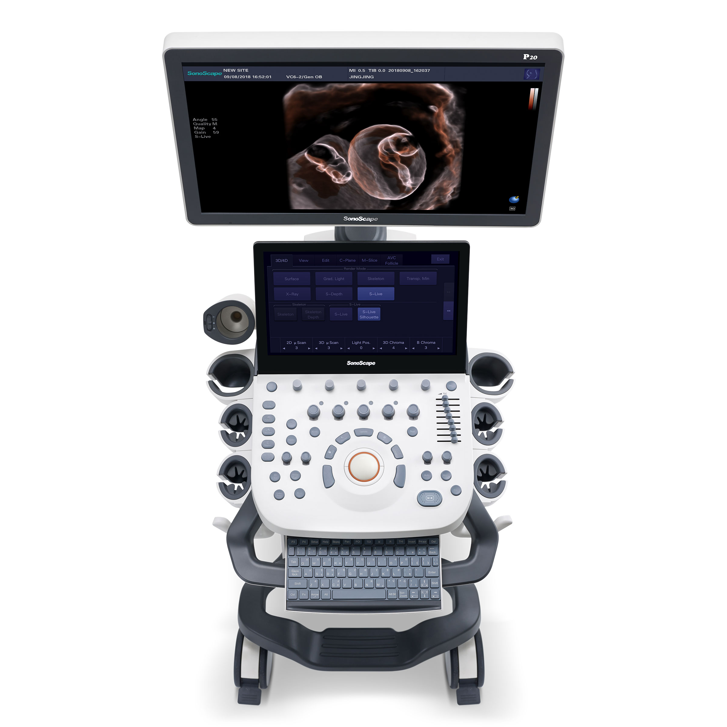 Sonoscape P20 Ultrasound System